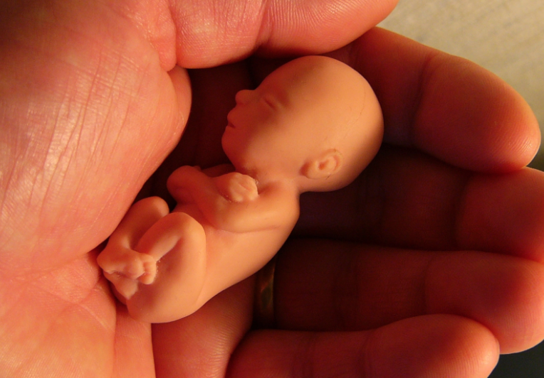 L'aborto in Italia: dal punto di vista legale e sociologico-statistico 1